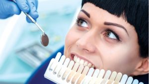 The Benefits of Professional Teeth Whitening