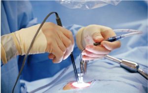 Minimally Invasive Orthopaedic Procedures: Benefits and Risks