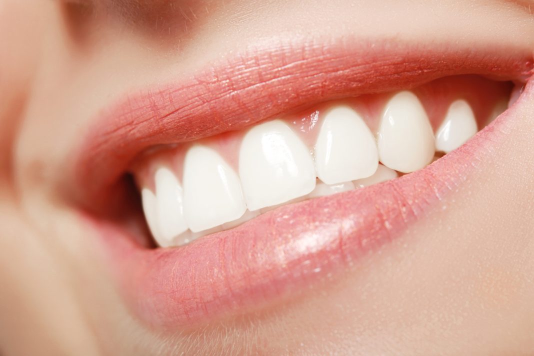 The Top 5 Affordable Dental Procedures to Improve Your Smile