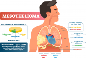 Asbestos and Aging: How Exposure Can Affect Your Health Later in Life