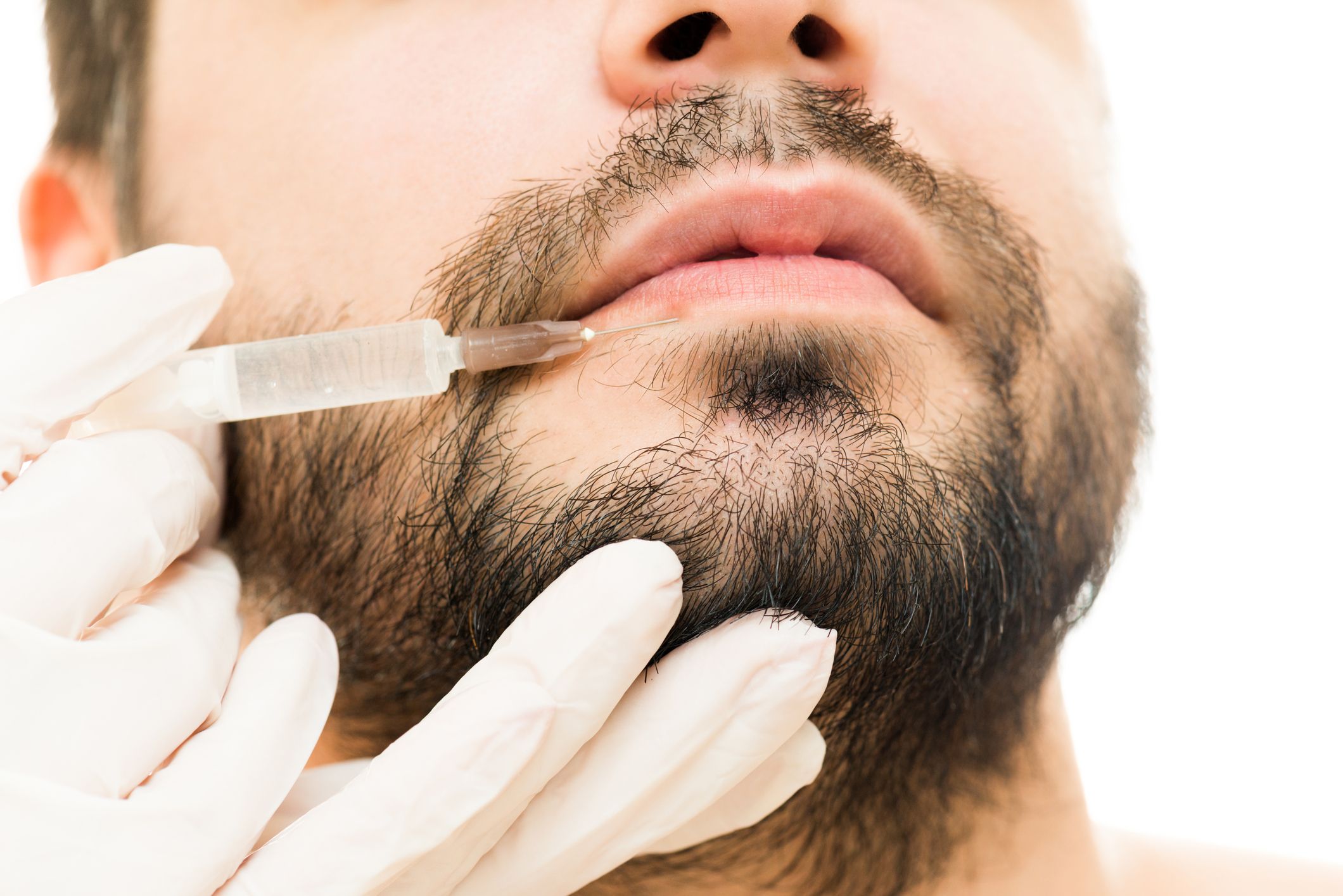 Botox and Dermal Fillers for Men: A Growing Trend